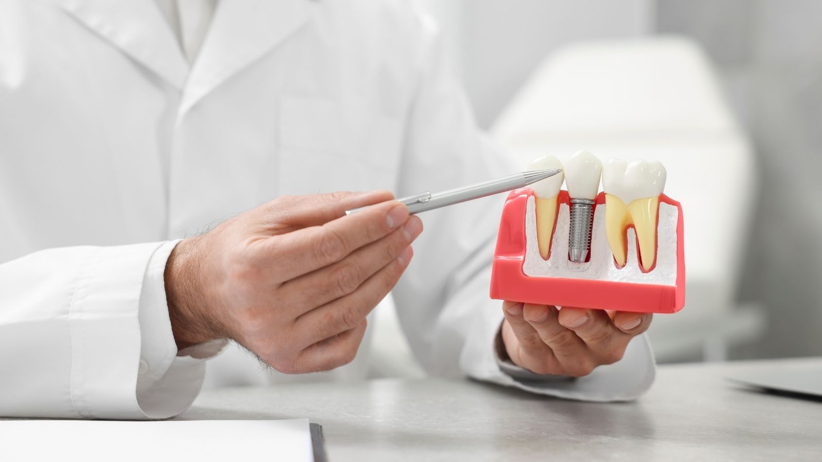 Kalemle implant sorunlarını gösteren doktor ve diş modeli