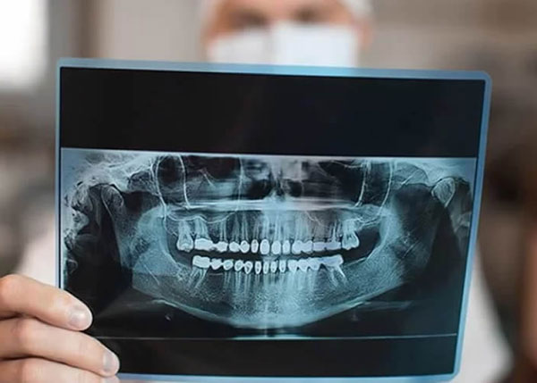 Dental Tomografi (Diş Tomografisi)