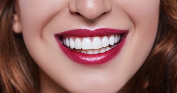 Gülüş Tasarımında Yüz Hatları Neden Dikkate Alınır