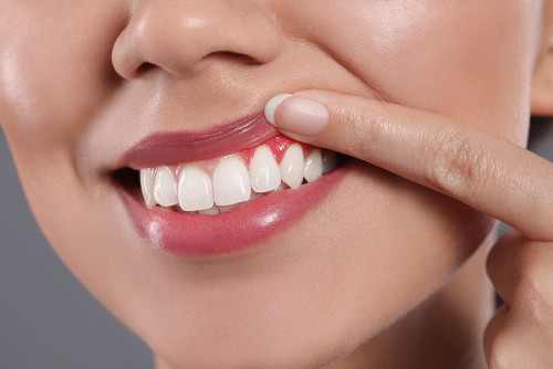 Periodontoloji