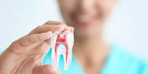 endodonti