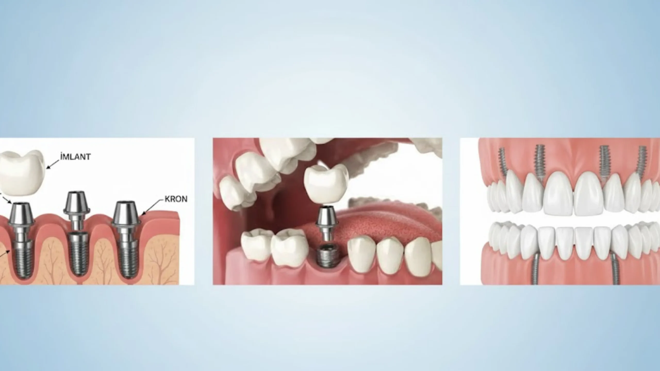 adsız tasarım (2) result